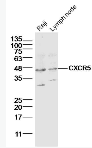 Anti-CXCR5 antibody-细胞表面趋化因子受体5（CD185）抗体,CXCR5