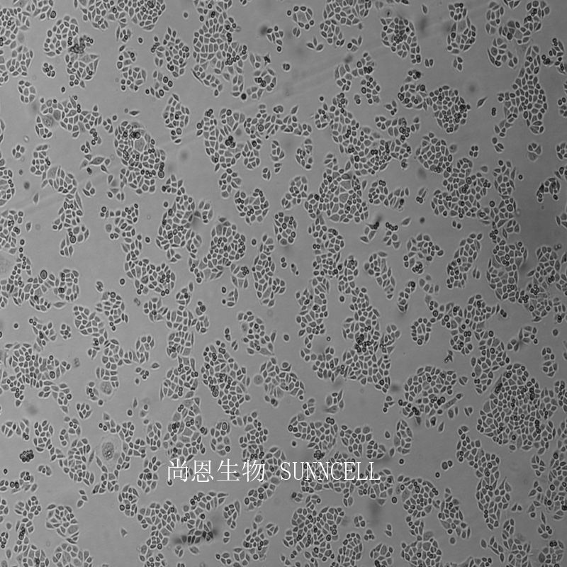 人胃腺癌细胞(低分化),BGC-823