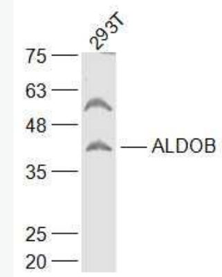 Anti-ALDOB antibody-醛缩酶2抗体,ALDOB