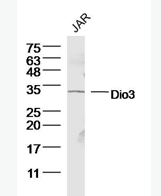Anti-Dio3 antibody-甲状腺素5'脱碘酶3抗体,Dio3