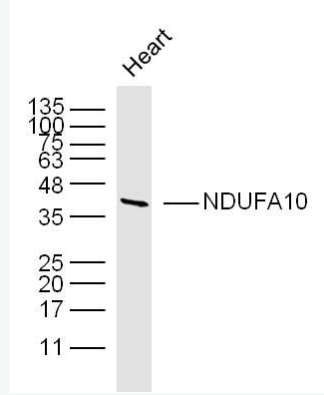 Anti-NDUFA10 antibody-NADH氧化还原酶辅酶10抗体,NDUFA10
