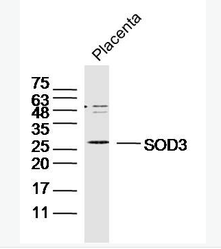 Anti-SOD3 antibody-超氧化物歧化酶3抗体,SOD3