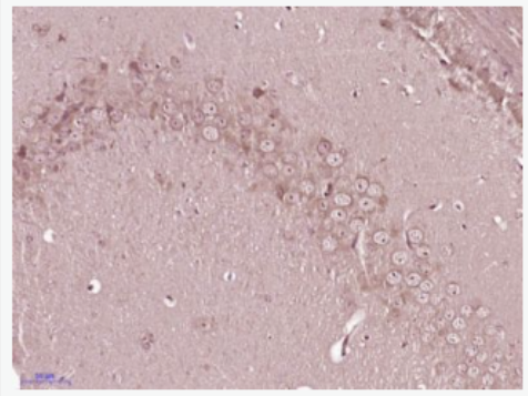 Anti-Glycogen synthase 1 antibody-葡萄糖合成酶1抗体,Glycogen synthase 1