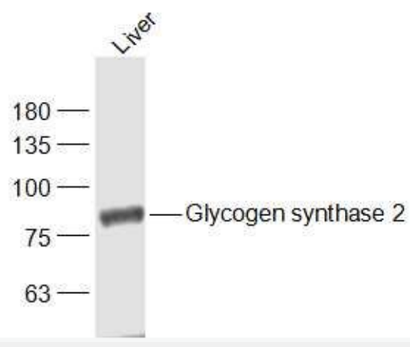 Anti-Glycogen synthase 2 antibody-葡萄糖合成酶2抗体,Glycogen synthase 2