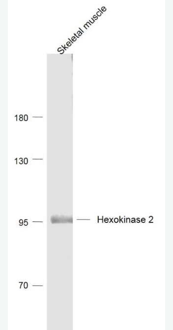 Anti-Hexokinase 2  antibody-己糖激酶2抗体,Hexokinase 2