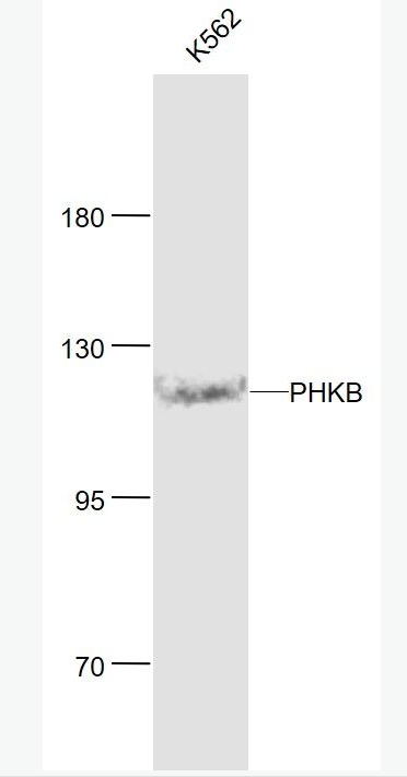 Anti-PHKB antibody-磷酸化酶β抗体,PHKB