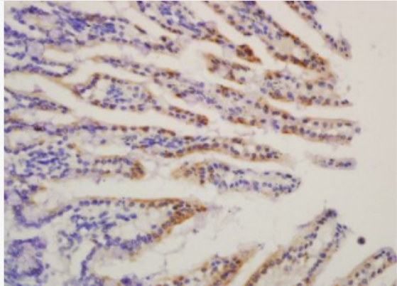 Anti-HMGCS2 antibody-三羟基三甲基辅酶A合成酶2抗体,HMGCS2