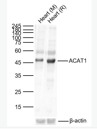 Anti-ACAT1 antibody-乙酰辅酶A酰基转移酶1抗体,ACAT1