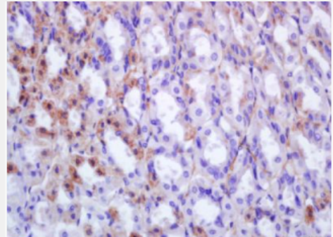 Anti-EPX antibody-嗜酸性粒细胞过氧化物酶抗体,EPX