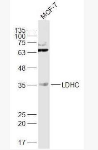 Anti-LDHC antibody-乳酸脱氢酶LDH-C/肿瘤/睾丸抗原32抗体,LDHC