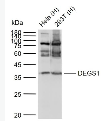 Anti-DEGS1 antibody-退行性精母细胞同源物1抗体,DEGS1