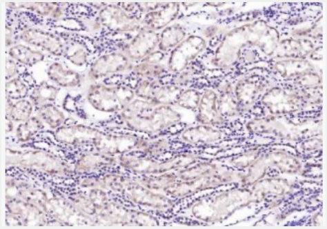 Anti-WNT10B antibody-信号通路WNT10B抗体,WNT10B