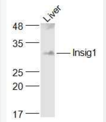 Anti-Insig1 antibody-胰岛素诱导基因1抗体,Insig1