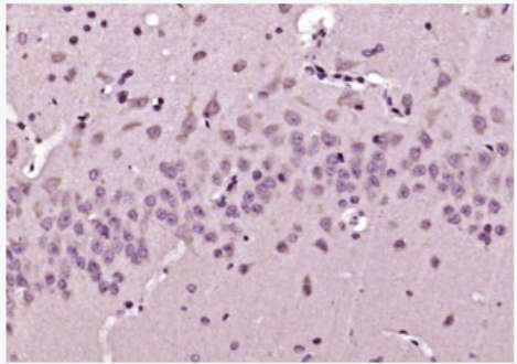 Anti-ERp29 antibody-内质网蛋白29抗体,ERp29