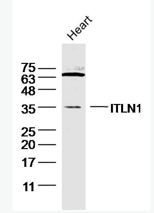 Anti-ITLN1 antibody-内皮细胞凝集素HL1抗体,ITLN1