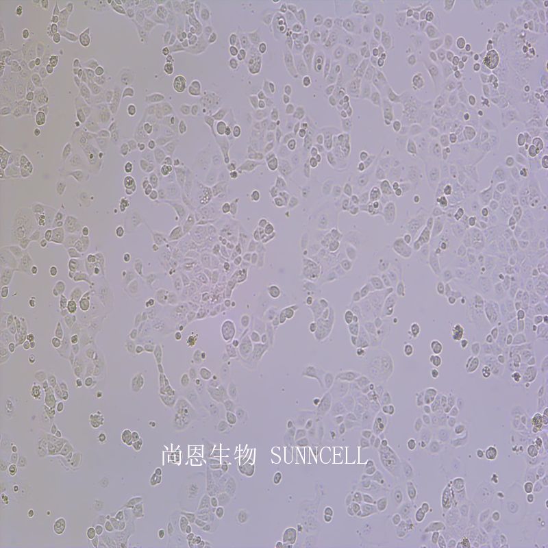 人子宫内膜腺癌细胞,KLE