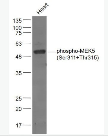 Anti-phospho-MEK5 (Ser311+Thr315) antibody-磷酸化丝裂原活化蛋白激酶激酶5抗体,phospho-MEK5 (Ser311+Thr315)