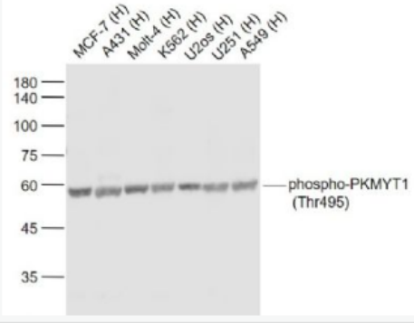 Anti-phospho-PKMYT1 (Thr495) antibody-磷酸化蛋白激酶PKMYT1(Thr495)抗体,phospho-PKMYT1 (Thr495)