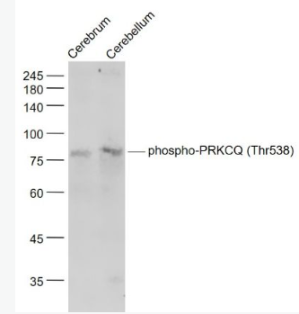 Anti-phospho-PRKCQ (Thr538) antibody-磷酸化蛋白激酶C theta抗体,phospho-PRKCQ (Thr538)