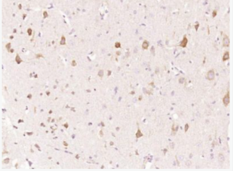 Anti-p53R2 antibody-核苷酸还原酶M2B抗体,p53R2