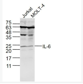 Anti-IL-6 antibody-白介素6,IL-6