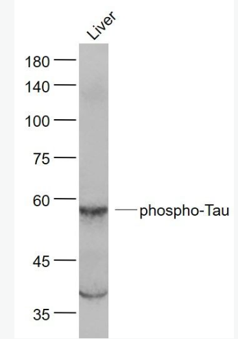 Anti-phospho-Tau (Ser214)  antibody-磷酸化微管相关蛋白抗体,phospho-Tau (Ser214)