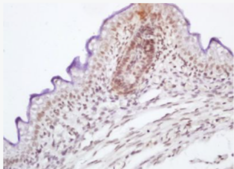 Anti-phospho-RAF1 (Ser339) antibody-磷酸化原癌基因RAF1抗体,phospho-RAF1 (Ser339)