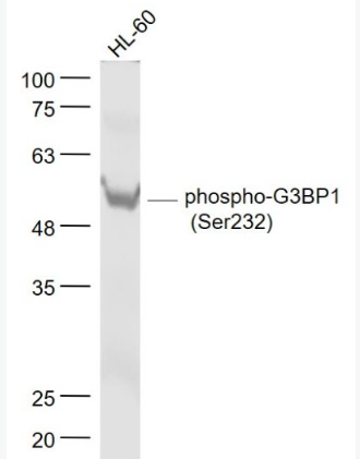 Anti-phospho-G3BP1 (Ser232) antibody-磷酸化Ras GTP酶活化蛋白结合蛋白1抗体,phospho-G3BP1 (Ser232)