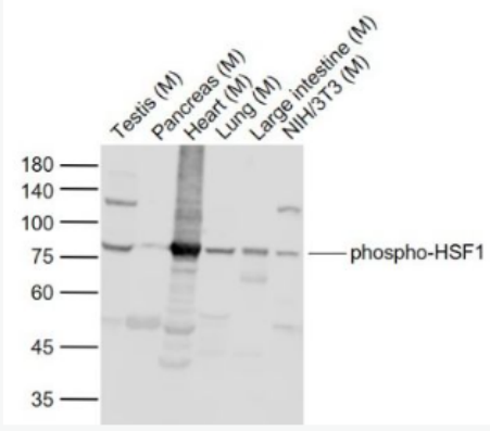 Anti-phospho-HSF1 (Ser307) antibody-磷酸化热休克因子1抗体,phospho-HSF1 (Ser307)