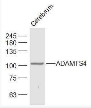 Anti-ADAMTS4 antibody-ADAMTS4抗體,ADAMTS4