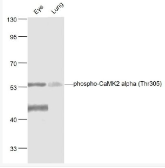 Anti-phospho-CaMK2 alpha (Thr305) antibody-磷酸化钙/钙调素依赖蛋白激酶2α抗体,phospho-CaMK2 alpha (Thr305)