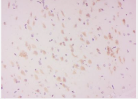 Anti-phospho-LATS2 (Ser83) antibody-磷酸化腫瘤抑制基因LATS2抗體,phospho-LATS2 (Ser83)