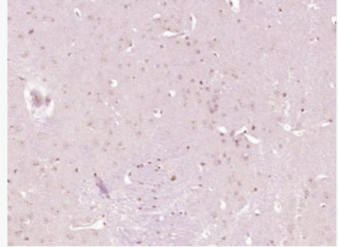 Anti-BMPR2 antibody-骨形態(tài)發(fā)生蛋白2受體抗體,BMPR2