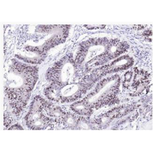 Anti-HCMV pp65 antibody-巨细胞病毒PP65/CMV低基质磷脂蛋白抗体