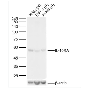 Anti-IL-10RA antibody-白细胞介素-10受体a抗体.