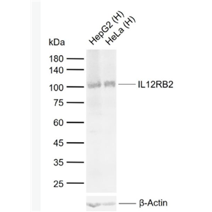 Anti-IL12RB2 antibody-白细胞介素-12受体β2抗体