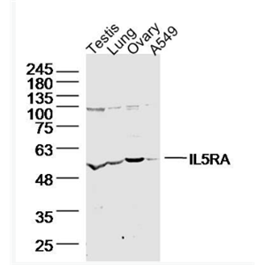 Anti-IL5RA antibody-白介素-5受体α链抗体IL-5Rα