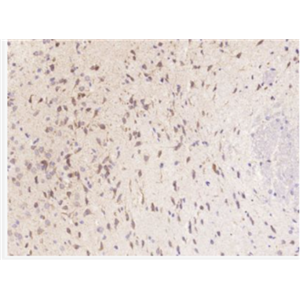 Anti-CXCL5 antibody-上皮中性粒细胞活化肽78抗体