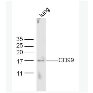 Anti-CD99 antibody-CD99抗体
