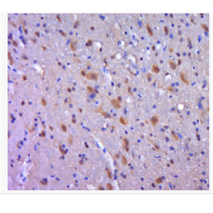 Anti-AIMP2 antibody-AIMP2抗體