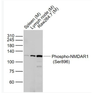 Anti-Phospho-NMDAR1 (Ser896) antibody-磷酸化离子型谷氨酸受体1抗体