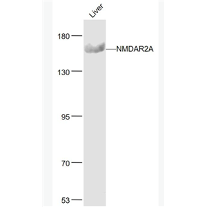 Anti-NMDAR2A antibody-谷氨酸受体2A抗体,NMDAR2A