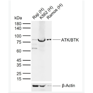 Anti-ATK/BTK antibody-酪氨酸蛋白激酶BTK抗体