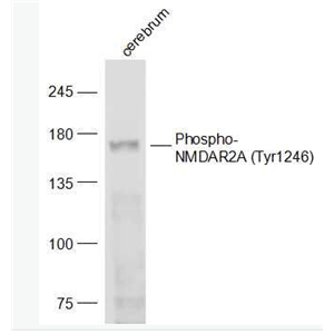 Anti-Phospho-NMDAR2A (Tyr1246) antibody-磷酸化谷氨酸受体2A抗体