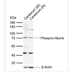Anti-Phospho-Numb (Ser276) antibody-磷酸化膜相关蛋白Numb抗体,Phospho-Numb (Ser276)