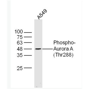 Anti-Phospho-Aurora A (Thr288) antibody-磷酸化有丝分裂激酶A抗体,Phospho-Aurora A (Thr288)