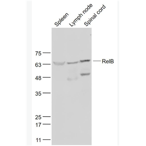 Anti-RelB antibody-核转录因子NFKB-RelB蛋白抗体