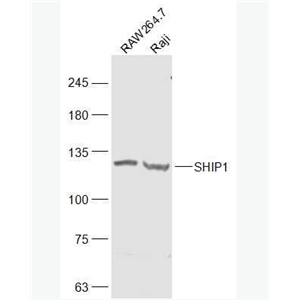 Anti-SHIP1 antibody-SH2结构含磷酸肌醇SHIP1抗体