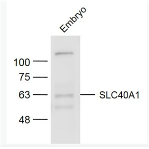 Anti-SLC40A1 antibody-细胞膜铁转运蛋白FP1抗体