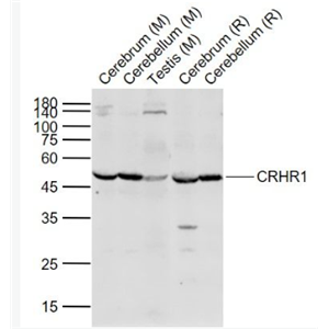 Anti-CRHR1 antibody-促肾上腺皮质释放激素受体1抗体